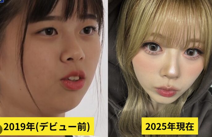 niziu リク 顔変わった