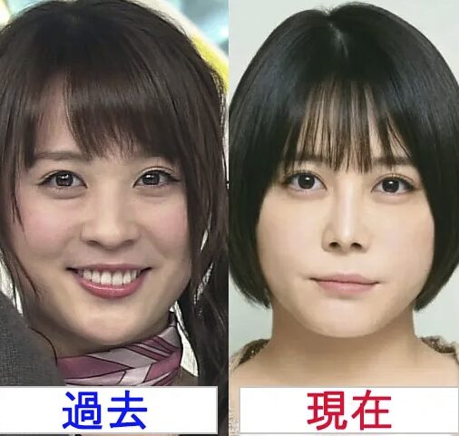 北乃きい 現在 顔変わった