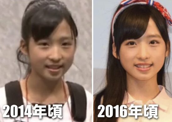 小栗有以 顔変わった