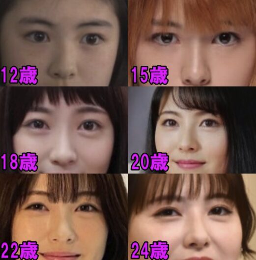 浜辺美波の顔が変わった？